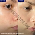 Dermive Sunblock Price in Pakistan | Oil Free Moisturizer